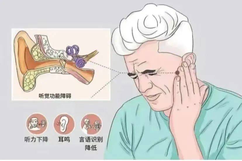 干細胞治療神經(jīng)性耳聾患者，有效治療聽力甚至耳聾！